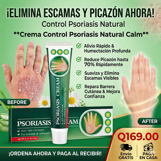 Crema Control Psoriasis Natural Calm